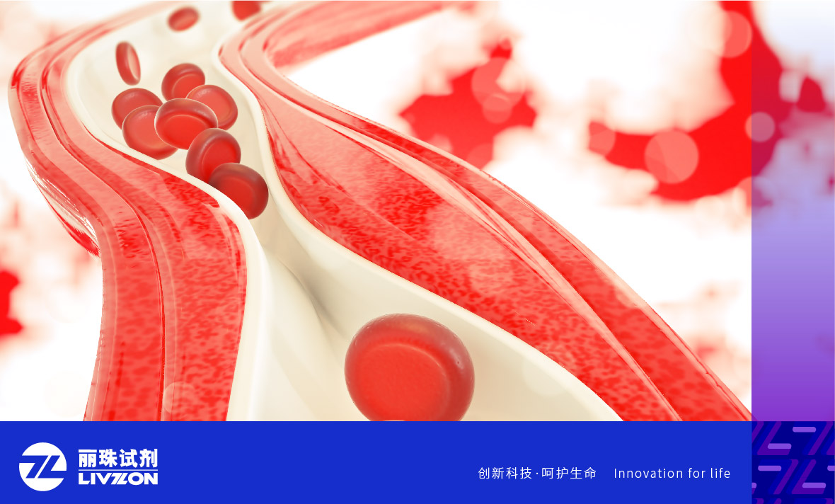 麗科普丨抗磷脂抗體陽性能診斷爲「 抗磷脂綜合征 」嗎？