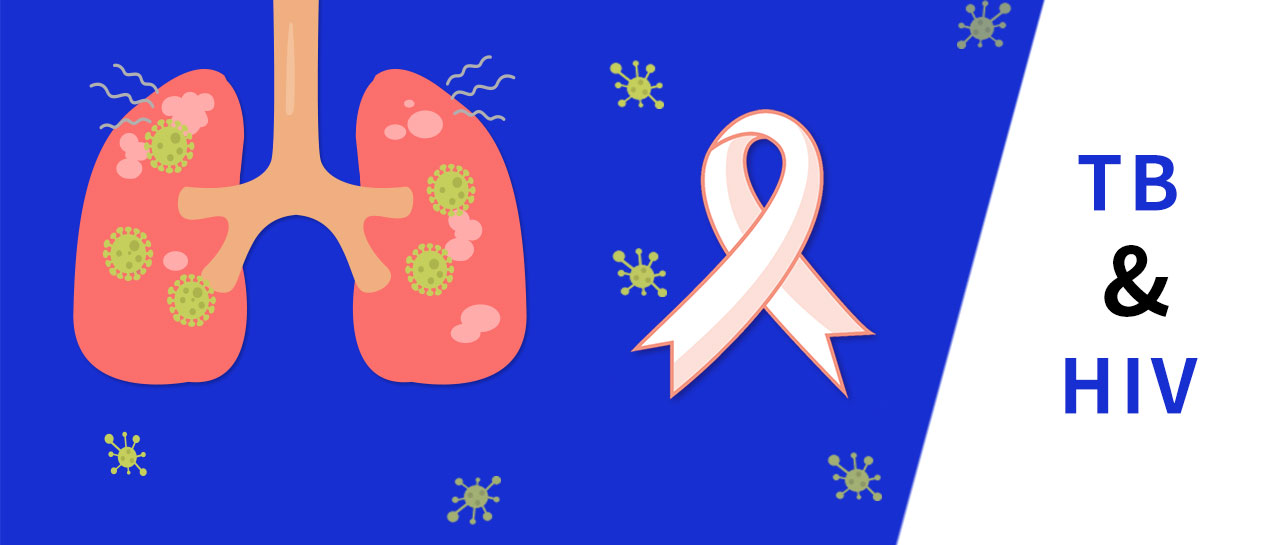 麗科普丨艾滋病+結核，不可輕視的“緻命搭檔”
